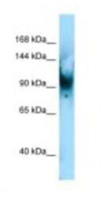 Western Blot: SENP6 Antibody [NBP1-98428] - Mouse Lung lysate, concentration 1.0ug/ml.