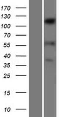 Western Blot: SENP6 Overexpression Lysate (Adult Normal) [NBP2-07141] Left-Empty vector transfected control cell lysate (HEK293 cell lysate); Right -Over-expression Lysate for SENP6.