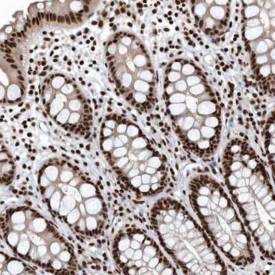 Immunohistochemistry-Paraffin: SENP7 Antibody [NBP1-86394] - Staining of human rectum shows strong nuclear positivity in glandular cells.