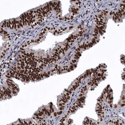 Immunohistochemistry-Paraffin SENP7 Antibody