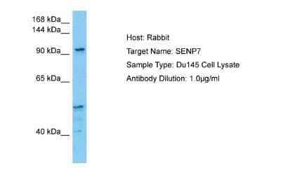 Western Blot: SENP7 Antibody [NBP2-88239] - Host: Rabbit. Target Name: SENP7. Sample Tissue: Human Du145 Whole Cell lysates. Antibody Dilution: 1ug/ml