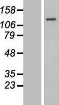 Western Blot: SENP7 Overexpression Lysate (Adult Normal) [NBP2-06609] Left-Empty vector transfected control cell lysate (HEK293 cell lysate); Right -Over-expression Lysate for SENP7.