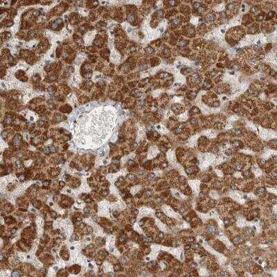 Immunohistochemistry: SERAC1 Antibody [NBP1-82218] - Staining of human liver shows strong cytoplasmic positivity in hepatocytes.