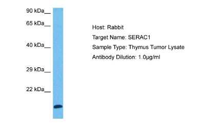 Western Blot: SERAC1 Antibody [NBP2-88240] - Host: Rabbit. Target Name: SERAC1. Sample Tissue: Human Thymus Tumor lysates. Antibody Dilution: 1ug/ml