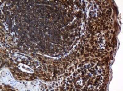 Immunohistochemistry: SERBP1 Antibody (5G2) [NBP2-45763] - Analysis of Human tonsil tissue. (Heat-induced epitope retrieval by 10mM citric buffer, pH6.0, 120C for 3min)