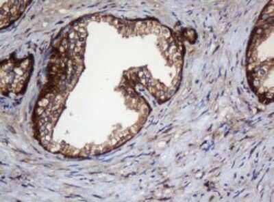 Immunohistochemistry: SERBP1 Antibody (5G2) [NBP2-45763] - Analysis of Human prostate tissue. (Heat-induced epitope retrieval by 10mM citric buffer, pH6.0, 120C for 3min)