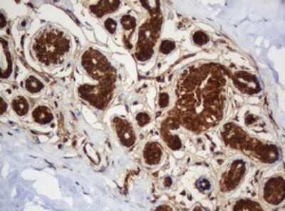 Immunohistochemistry: SERBP1 Antibody (5G2) [NBP2-45763] - Analysis of Human breast tissue. (Heat-induced epitope retrieval by 10mM citric buffer, pH6.0, 120C for 3min)