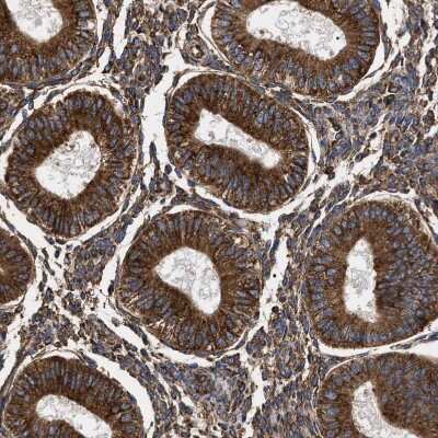 Immunohistochemistry-Paraffin: SERBP1 Antibody [NBP1-85660] - Staining of human endometrium shows strong cytoplasmic positivity in glandular cells.