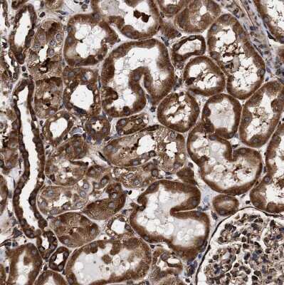 Immunohistochemistry-Paraffin: SERBP1 Antibody [NBP1-85660] - Staining of human kidney shows strong cytoplasmic positivity in cells in tubules.