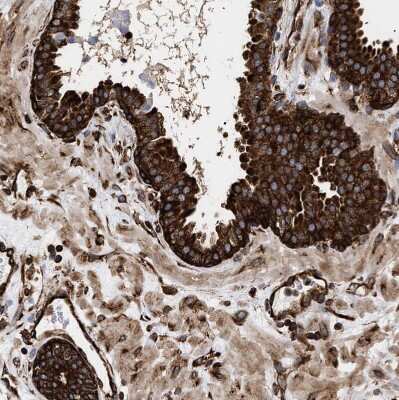 Immunohistochemistry-Paraffin: SERBP1 Antibody [NBP1-85660] - Staining of human prostate shows strong cytoplasmic positivity in glandular cells.