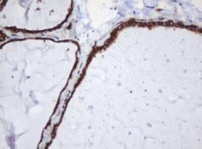 Immunohistochemistry: SERBP1 Antibody (OTI5G2) - Azide and BSA Free [NBP2-74073] - Analysis of Human thyroid tissue. (Heat-induced epitope retrieval by 10mM citric buffer, pH6.0, 120C for 3min)