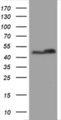 Western Blot: SERBP1 Antibody (OTI5G2) - Azide and BSA Free [NBP2-74073] - Analysis of HEK293T cells were transfected with the pCMV6-ENTRY control (Left lane) or pCMV6-ENTRY SERBP1.