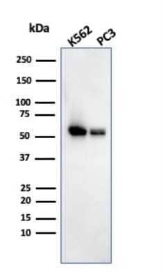 Western Blot: SERBP1 Antibody (SERBP1/3493) [NBP2-79805] - Staining on human testis (Formalin-Fixed Paraffin-Embedded (FFPE)) Image using the Azide and BSA Free format of this antibody.