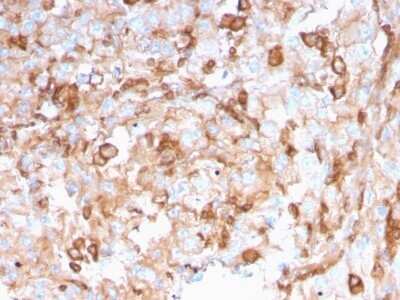 Immunohistochemistry-Paraffin: SERBP1 Antibody (SERBP1/3496) - Azide and BSA Free [NBP2-79844] - Formalin-fixed, paraffin-embedded human Kidney stained with SERBP1 Antibody (SERBP1/3496).