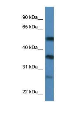 Western Blot: SERBP1 Antibody [NBP1-57210] - MCF-7 whole cell lysates, concentration 0.2-1 ug/ml.