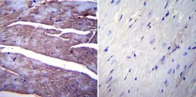Immunohistochemistry-Paraffin: SERCA1 ATPase Antibody (IIH11) [NB120-2818] - Normal biopsies of deparaffinized Mouse heart tissue.