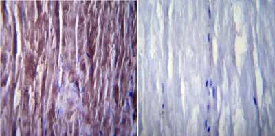 Immunohistochemistry-Paraffin: SERCA1 ATPase Antibody (IIH11) [NB120-2818] - Normal biopsies of deparaffinized Mouse skeletal muscle tissue.
