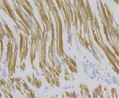 Immunohistochemistry: SERCA1 ATPase Antibody (JE45-75) [NBP2-76891] - Immunohistochemical analysis of paraffin-embedded human fetal skeletal muscle tissue using anti-SERCA1 ATPase antibody. The section was pre-treated using heat mediated antigen retrieval with sodium citrate buffer (pH 6.0) for 20 mins. The tissues were blocked in 5% BSA for 30 minutes at room temperature, washed with ddH2O and PBS, and then probed with the antibody at 1/200 dilution, for 30 minutes at room temperature and detected using an HRP conjugated compact polymer system. DAB was used as the chrogen. Counter stained with hematoxylin and mounted with DPX.