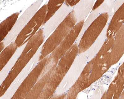 Immunohistochemistry-Paraffin: SERCA1 ATPase Antibody (JE45-75) [NBP2-76891] - Analysis of paraffin-embedded human striated muscle tissue with Rabbit anti-SERCA1 ATPase antibody washed with ddH2O and PBS, and then probed with the primary antibody  at 1/400 dilution for 1 hour at room temperature. The detection was performed using an HRP conjugated compact polymer system. DAB was used as the chromogen. Tissues were counterstained with hematoxylin and mounted with DPX.