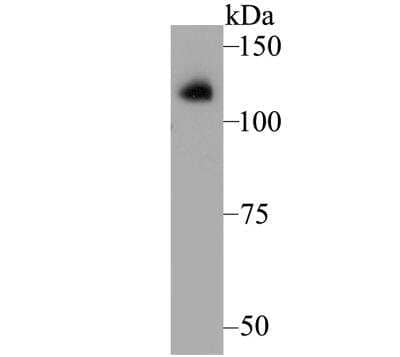 Western Blot: SERCA1 ATPase Antibody (JE45-75) [NBP2-76891] - Western blot analysis of SERCA1 ATPase on human fetal skeletal muscle tissue lysate. Proteins were transferred to a PVDF membrane and blocked with 5% BSA in PBS for 1 hour at room temperature. The primary antibody was used at a 1:500 dilution in 5% BSA at room temperature for 2 hours. Goat Anti-Rabbit IgG - HRP Secondary Antibody at 1:5,000 dilution was used for 1 hour at room temperature.