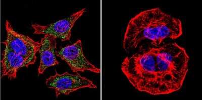 Immunocytochemistry/Immunofluorescence: SERCA1 ATPase Antibody (VE121G9) [NB300-622] - SERCA1 ATPase staining (green), F-Actin staining with Phalloidin (red) and nuclei with DAPI (blue) is shown. Cells were grown on chamber slides and fixed with formaldehyde prior to staining. Cells were probed without (control) or with or an antibody recognizing SERCA1 ATPase at a dilution of 1:20 over night at 4C, washed with PBS and incubated with a DyLight-488 conjugated.