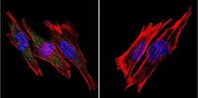 Immunocytochemistry/Immunofluorescence: SERCA1 ATPase Antibody (VE121G9) [NB300-622] - SERCA1 ATPase staining (green), F-Actin staining with Phalloidin (red) and nuclei with DAPI (blue) is shown. Cells were grown on chamber slides and fixed with formaldehyde prior to staining. Cells were probed without (control) or with or an antibody recognizing SERCA1 ATPase at a dilution of 1:20 over night at 4C, washed with PBS and incubated with a DyLight-488 conjugated.