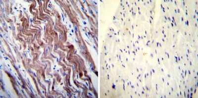 Immunohistochemistry-Paraffin: SERCA1 ATPase Antibody (VE121G9) [NB300-622] - Both normal and cancer biopsies of deparaffinized Human heart tissue tissues.
