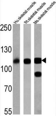 Western Blot: SERCA1 ATPase Antibody (VE121G9) [NB300-622] - Analysis of  25 ug of human skeletal muscle (lane 1), rat skeletal muscle (lane 2) and mouse skeletal muscle (lane 3).