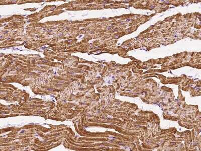 Immunohistochemistry-Paraffin: SERCA2 ATPase Antibody [NBP2-97582] - Immunochemical staining SERCA2 ATPase in human skeletal muscle with rabbit polyclonal antibody at 1:200 dilution, formalin-fixed paraffin embedded sections.