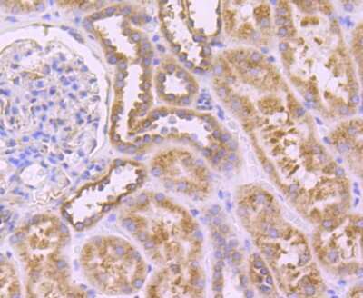 Immunohistochemistry-Paraffin: SERCA2 ATPase Antibody (JM10-20) [NBP2-67133] - Analysis of paraffin-embedded human kidney tissue using anti-SERCA2 antibody. Counter stained with hematoxylin.