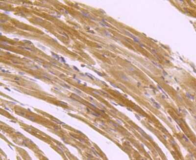 Immunohistochemistry-Paraffin: SERCA2 ATPase Antibody (JM10-20) [NBP2-67133] - Analysis of paraffin-embedded mouse heart tissue using anti-SERCA2 antibody. Counter stained with hematoxylin.