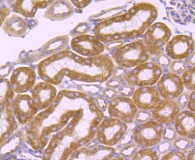 Immunohistochemistry-Paraffin: SERCA2 ATPase Antibody (JM10-20) [NBP2-67133] - Analysis of paraffin-embedded mouse kidney tissue using anti-SERCA2 antibody. Counter stained with hematoxylin.