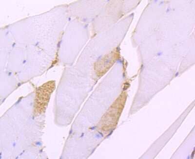 Immunohistochemistry-Paraffin: SERCA2 ATPase Antibody (JM10-20) [NBP2-67133] - Analysis of paraffin-embedded mouse skeletal muscle tissue using anti-SERCA2 antibody. Counter stained with hematoxylin.