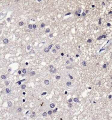Immunohistochemistry: SERF1A Antibody [NBP1-78393] - Analysis of SERF1A  in human Alzheimer's brain using DAB with hematoxylin counterstain.