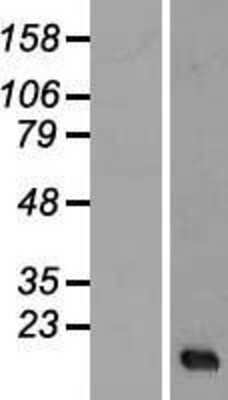 Western Blot: SERHL Overexpression Lysate (Adult Normal) [NBL1-15827] Left-Empty vector transfected control cell lysate (HEK293 cell lysate); Right -Over-expression Lysate for SERHL.