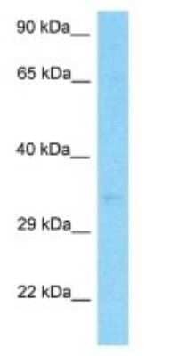 Western Blot: SERHL2 Antibody [NBP3-09374] - Western blot analysis of SERHL2 in Stomach Tumor lysates. Antibody dilution at 1.0ug/ml