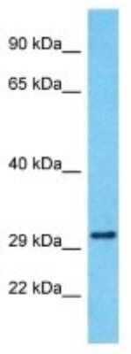 Western Blot: SERINC4 Antibody [NBP3-09887] - Western blot analysis of SERINC4 in Human MCF7 Whole Cell. Antibody dilution at 1ug/ml
