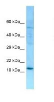 Western Blot: SERP1 Antibody [NBP1-98592] - Titration: 1.0 ug/ml Positive Control: MCF7 Whole Cell.