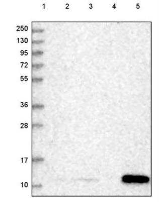 Western Blot: SERP1 Antibody [NBP2-54686] - Lane 1: Marker [kDa] 250, 130, 95, 72, 55, 36, 28, 17, 10Lane 2: Human cell line RT-4 Lane 3: Human cell line U-251 MG Lane 4: Human plasma Lane 5: Human Liver tissue