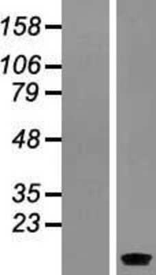 Western Blot: SERP1 Overexpression Lysate (Adult Normal) [NBL1-15831] Left-Empty vector transfected control cell lysate (HEK293 cell lysate); Right -Over-expression Lysate for SERP1.