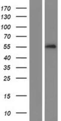 Western Blot Serpin A10/ZPI Overexpression Lysate