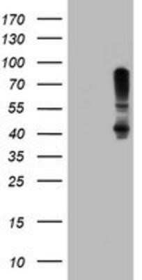 Western Blot: SERPINB1 Antibody (OTI3B4) - Azide and BSA Free [NBP2-74123] - HEK293T cells were transfected with the pCMV6-ENTRY control (Left lane) or pCMV6-ENTRY SERPINB1 (Right lane) cDNA for 48 hrs and lysed. Equivalent amounts of cell lysates (5 ug per lane) were separated by SDS-PAGE and immunoblotted with anti-SERPINB1.