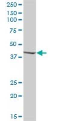 Western Blot: SERPINB1 Antibody [H00001992-B01P] - Analysis of SERPINB1 expression in human pancreas.