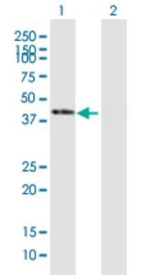 Western Blot: SERPINB1 Antibody [H00001992-B01P] - Analysis of SERPINB1 expression in transfected 293T cell line by SERPINB1 polyclonal antibody.  Lane 1: SERPINB1 transfected lysate(41.69 KDa). Lane 2: Non-transfected lysate.