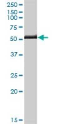 Western Blot: SERPINB1 Antibody [H00001992-D01P] - Analysis of SERPINB1 expression in human liver.