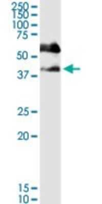 Western Blot: SERPINB1 Antibody [H00001992-D01P] - Analysis of SERPINB1 expression in human pancreas.