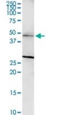 Western Blot: SERPINB1 Antibody [H00001992-D01P] - Analysis of SERPINB1 expression in mouse kidney.