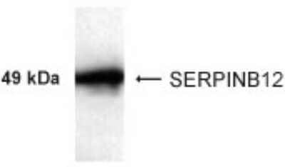 Western Blot: SERPINB12 Antibody [NB100-93572] - Western blot analysis of 3 ug of recombinant SERPINB12 using NB100-93572 at 1:1000 dilution