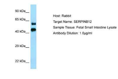 Western Blot: SERPINB12 Antibody [NBP1-98386] - Antibody Dilution: 1.0ug/ml Sample Tissue: Human Small Intestine.