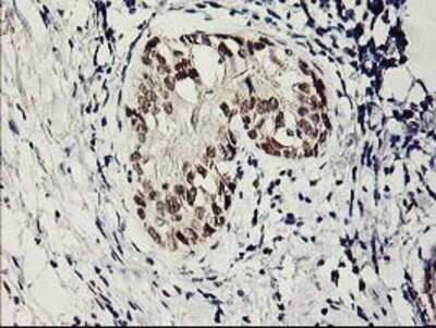 Immunohistochemistry-Paraffin SERPINB13 Antibody (OTI2B6)